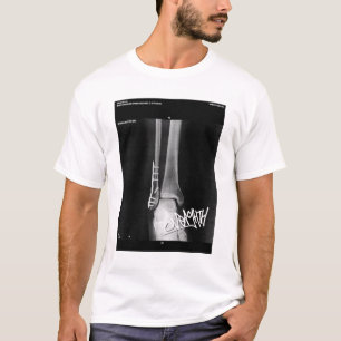 KNOCHENKRASCHER (UNTER REPARATUR) NACH DEM Tōkyō T-Shirt