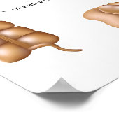 Kolonpathologie Poster (Ecke)