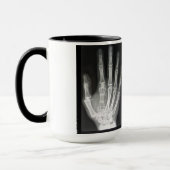 Königin im Handröntgenstrahl Tasse (Links)