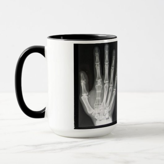 Königin im Handröntgenstrahl Tasse (Links)