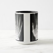 Königin im Handröntgenstrahl Tasse (Zentrum)