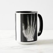 Königin im Handröntgenstrahl Tasse (VorderseiteRechts)