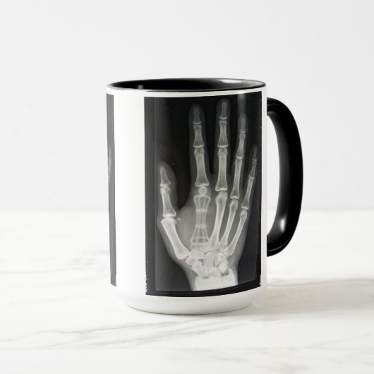 Königin im Handröntgenstrahl Tasse (VorderseiteRechts)