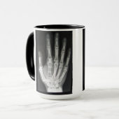 Königin im Handröntgenstrahl Tasse (Vorderseite Links)