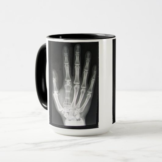 Königin im Handröntgenstrahl Tasse (Vorderseite Links)