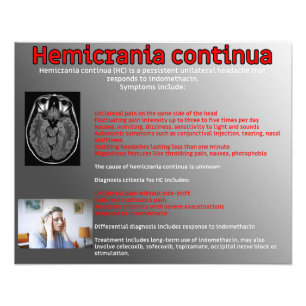 Kontinuität der Hemikranie Fotodruck