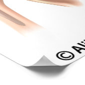 Konventionelle oder umgekehrte Gesamtersatzschulte Poster (Ecke)