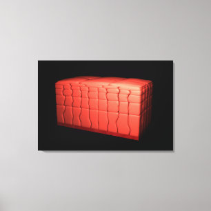 Konzept des ratifizierten Plattenepithels 1 Leinwanddruck