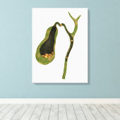 Konzeptbild von Gallstones im Gall Leinwanddruck (Insitu (Holzboden))