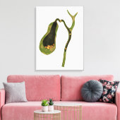 Konzeptbild von Gallstones im Gall Leinwanddruck (Insitu (Wohnzimmer))