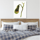 Konzeptbild von Gallstones im Gall Leinwanddruck (Insitu (Schlafzimmer))