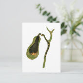 Konzeptbild von Gallstones im Gall Postkarte (Stehend Vorderseite)