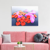 Konzeptuelles Bild der Sichelzellanämie Leinwanddruck (Insitu (Wohnzimmer))