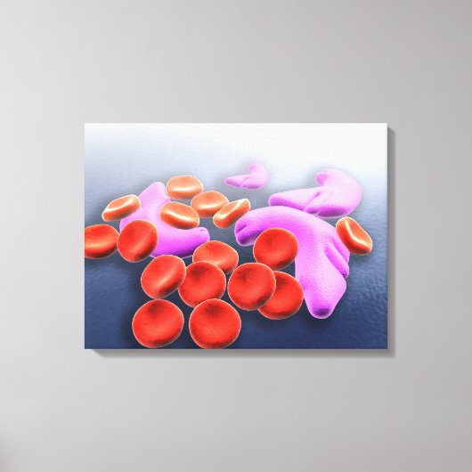 Konzeptuelles Bild der Sichelzellanämie Leinwanddruck (Vorderseite)