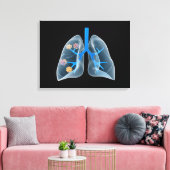 Konzeptuelles Bild des menschlichen Herzens 4 Leinwanddruck (Insitu (Wohnzimmer))