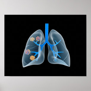 Konzeptuelles Bild des menschlichen Herzens 4 Poster