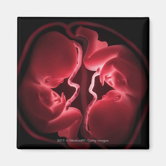 Konzeptuelles Bild einer Gebärmutter mit Zwillinge Magnet (Vorne)