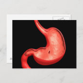 Konzeptuelles Bild eines peptischen Ulkus im Magen Postkarte (Vorne/Hinten)