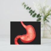 Konzeptuelles Bild eines peptischen Ulkus im Magen Postkarte (Stehend Vorderseite)