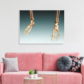 Konzeptuelles Bild von Knochen in menschlichen Bei Leinwanddruck (Insitu (Wohnzimmer))