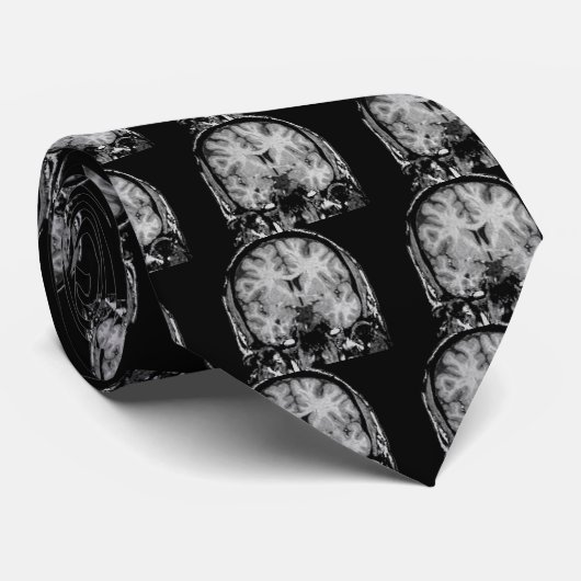 Kranzscheibe MRI Krawatte (Gerollt)