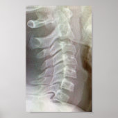 Krawatte der Wirbelsäule Poster (Vorne)