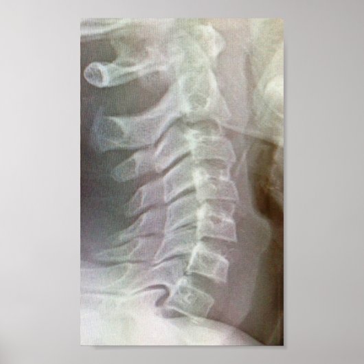 Krawatte der Wirbelsäule Poster (Vorne)