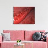 Kreuzung mit rotem Blutkörperchen Leinwanddruck (Insitu (Wohnzimmer))