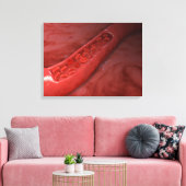 Kreuzung mit rotem Blutkörperchen Leinwanddruck (Insitu (Wohnzimmer))
