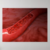Kreuzung mit rotem Blutkörperchen Poster (Vorne)