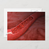 Kreuzung mit rotem Blutkörperchen Postkarte (Vorne/Hinten)