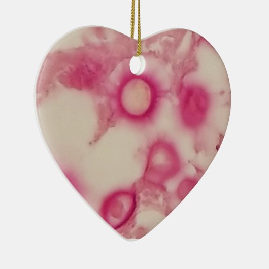 Kryptokokken-Ornament Keramik Ornament (Rechts)