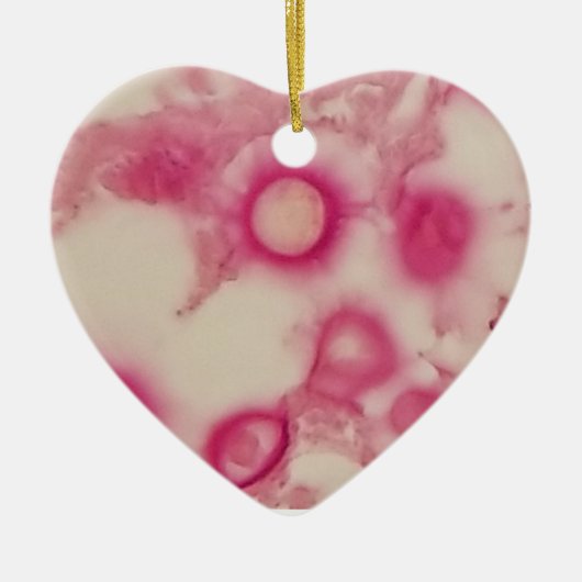 Kryptokokken-Ornament Keramik Ornament (Vorne)