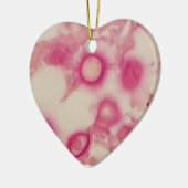 Kryptokokken-Ornament Keramik Ornament (Links)