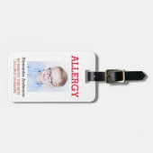 Kundenspezifisches Foto scherzt Allergie wachsames Gepäckanhänger (Vorderseite horizontal)