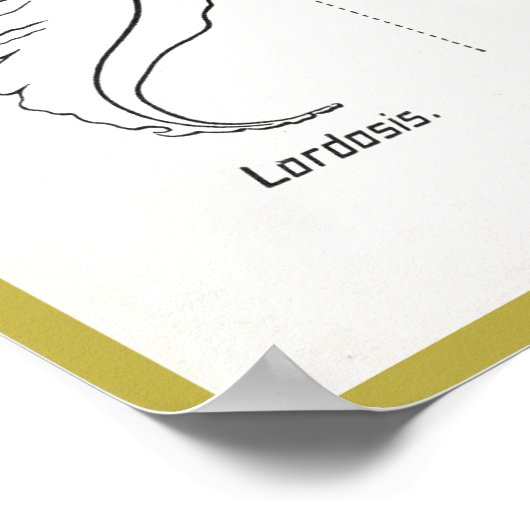 Kurven des Spine Poster Chiropraktik (Ecke)