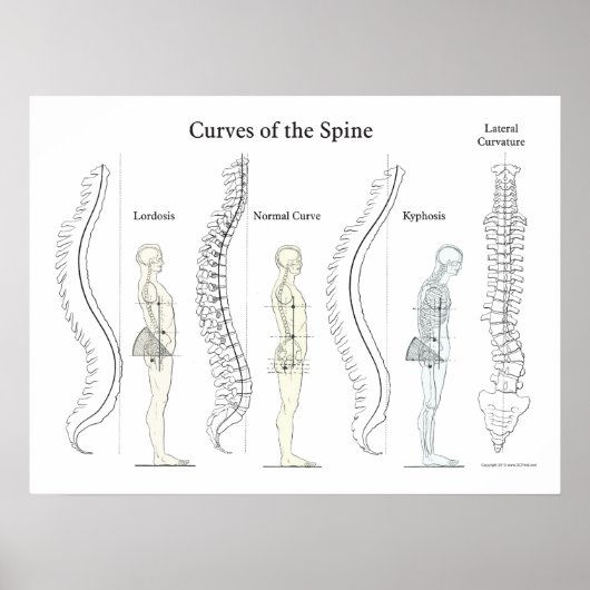Kurven des Spine Poster Chiropraktik (Vorne)