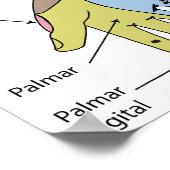 Kutane Infektion Poster (Ecke)