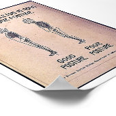 Lage des Skeletts in guter und schlechter Haltung Poster (Ecke)