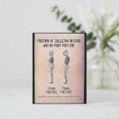 Lage des Skeletts in guter und schlechter Haltung Postkarte (Stehend Vorderseite)