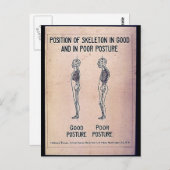 Lage des Skeletts in guter und schlechter Haltung Postkarte (Vorne/Hinten)