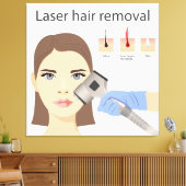 Laser-Haarentfernungsstruktur Leinwanddruck (Insitu (Wohnzimmer))