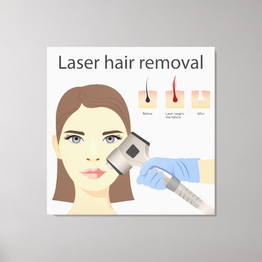 Laser-Haarentfernungsstruktur Leinwanddruck (Vorderseite)