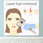 Laser-Haarentfernungsstruktur Leinwanddruck (Insitu (Holzboden))