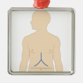 Leber-Transplantation Silbernes Ornament (Vorne)