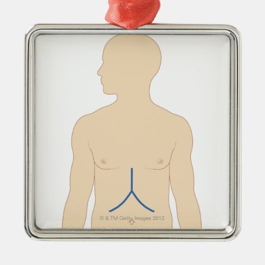 Leber-Transplantation Silbernes Ornament (Vorne)