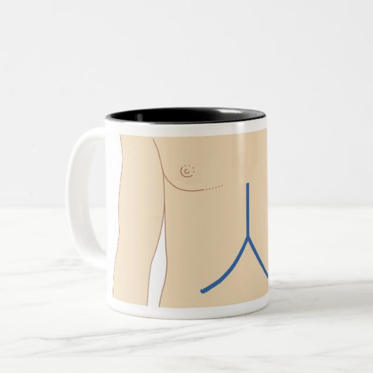 Leber-Transplantation Zweifarbige Tasse (Vorderseite Links)