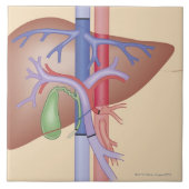 Leber-Transplantations-Verfahren Fliese (Vorderseite)