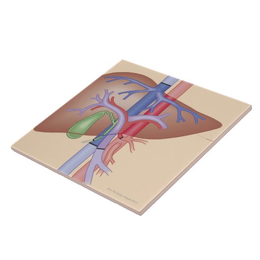 Leber-Transplantations-Verfahren Fliese (Seite)