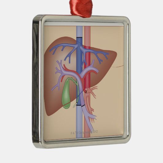 Leber-Transplantations-Verfahren Silbernes Ornament (Rechts)